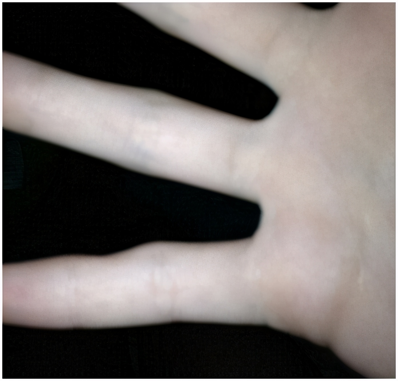 经常玩手机小拇指都弯了,长期玩手机小拇指弯曲是怎么回事