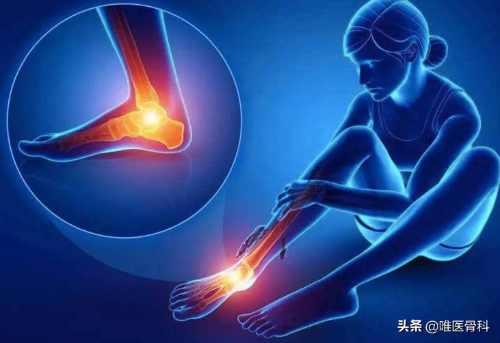 足底筋膜炎可以快走吗,足底筋膜炎快走