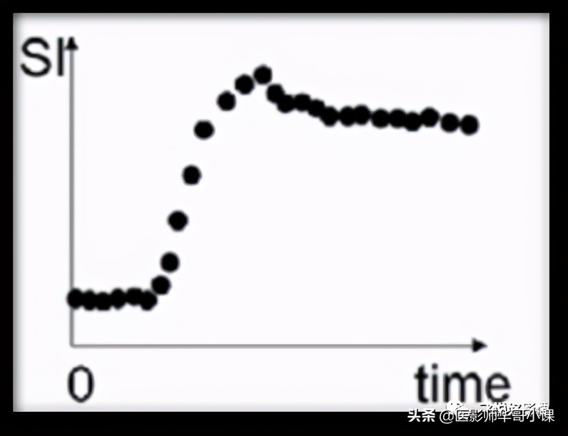 飞利浦磁共振系统界面及操作流程,飞利浦磁共振技术学习