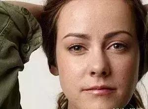 夏天脸上很干燥怎么补水,夏天脸上干燥起皮什么原因