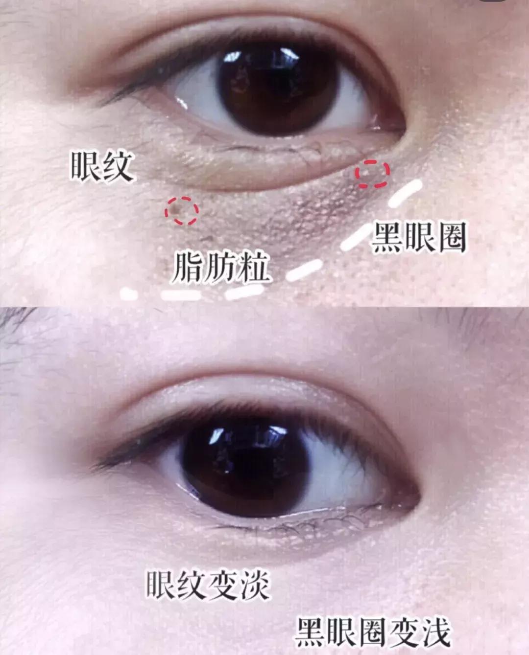 有了前法国第一夫人的百元“黑科技”眼霜，我把3000块眼霜扔了！