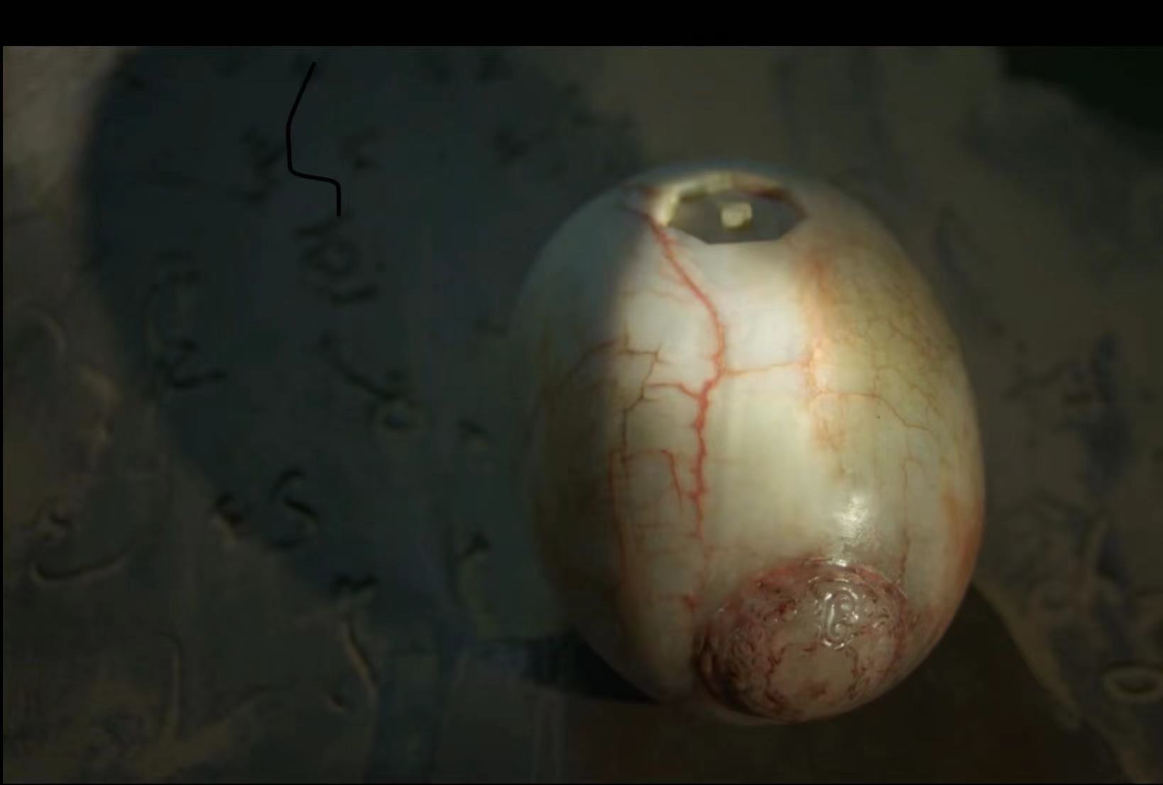 雮尘珠诅咒最后在哪解除的,红斑诅咒是什么