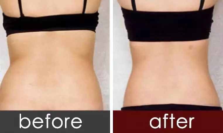 背上全是肉怎么减肥,瘦背部拜拜肉变薄的最好方法