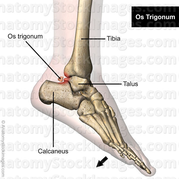 伸直后腿筋疼是怎么回事,前脚踝撞击综合征怎么治疗