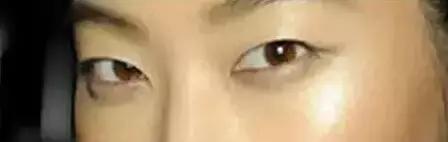 把水光针当饭吃？这位网红简直丧心病狂！整容后年入千万