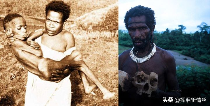 朊毒体是只有人类有吗,朊毒体属于特殊感染吗