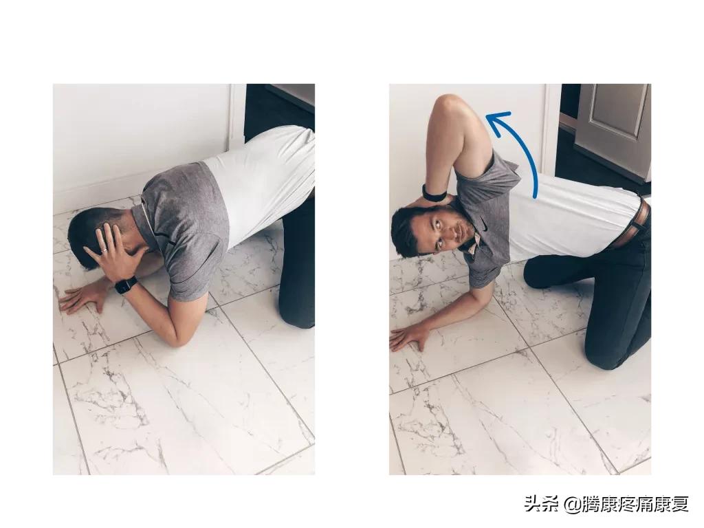 肩峰下撞击综合征的症状,肩峰下撞击综合征的机制是什么