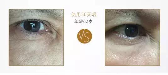 有了前法国第一夫人的百元“黑科技”眼霜，我把3000块眼霜扔了！