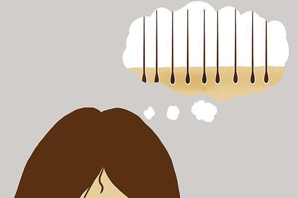 抓头发指甲里面有白泥,头发用指甲抠一下有很多白泥