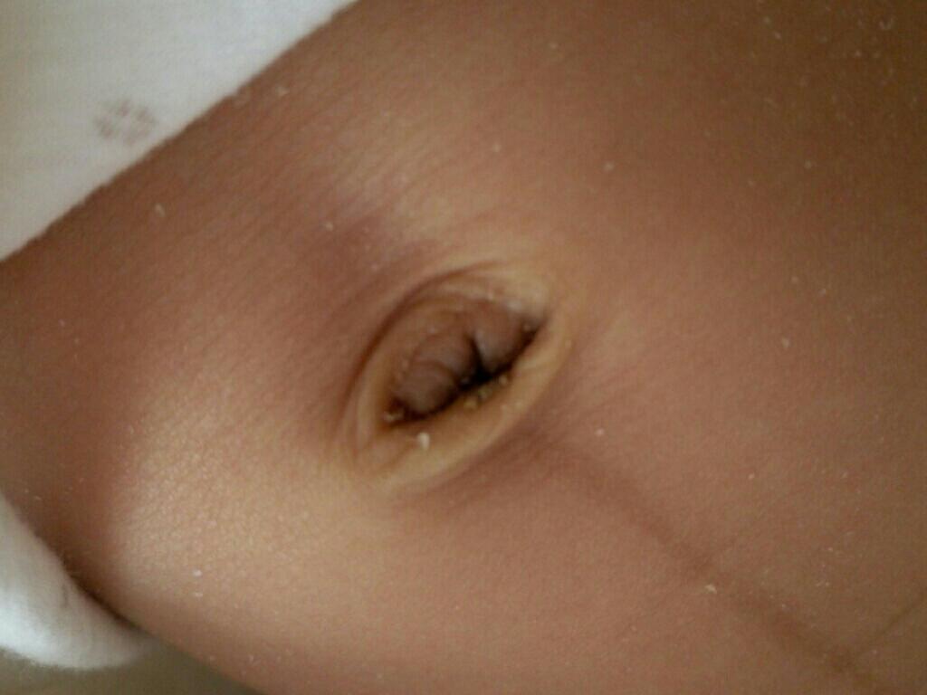 宝宝三个地方越脏越好,宝宝身上长期皮肤污垢怎么去除