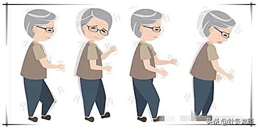 老年人拿东西时手抖是什么原因,老年人手抖嘴角抖是什么原因