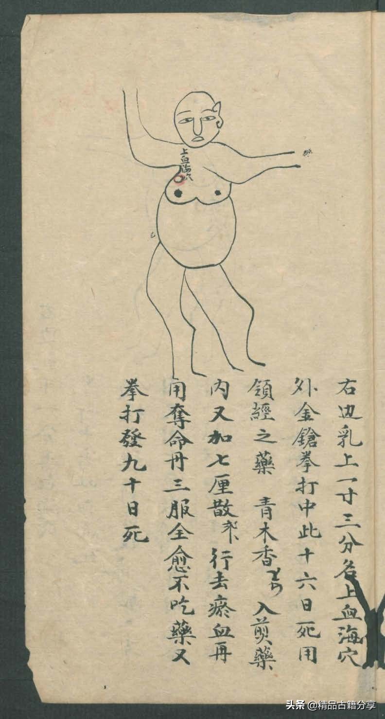 中医类抄本跌打损伤方面的医书欢迎阅读