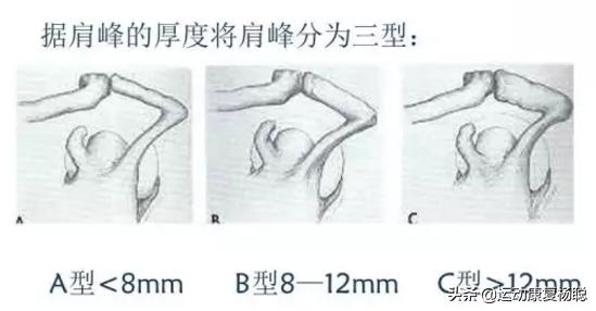 肩关节弹响的原因和解决办法,偏瘫患者肩关节弹响怎么回事