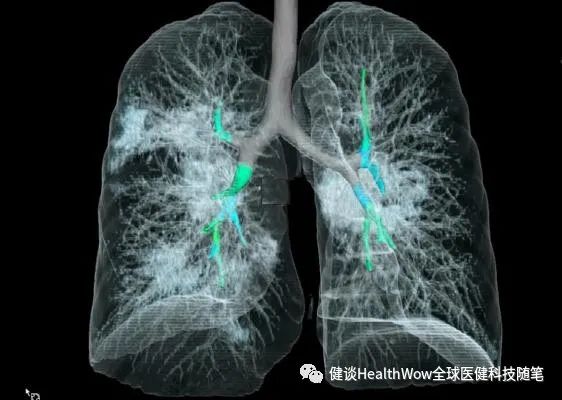 特斯拉呼吸机生产线,特斯拉用汽车零部件制造呼吸机