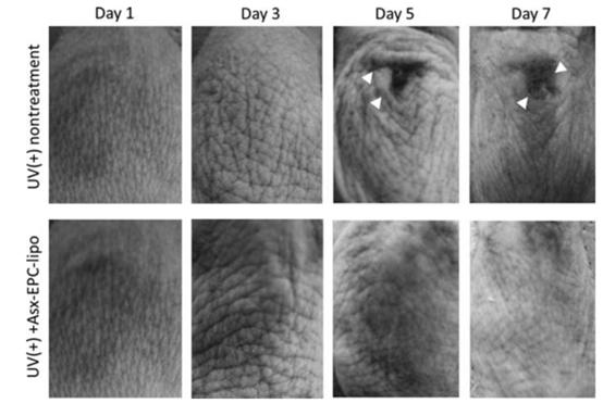 虾青素抗氧化第一名,虾青素地表最强抗氧化剂