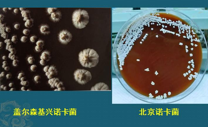 肺诺卡菌感染，当1种分解落叶的细菌，被吸入肺脏