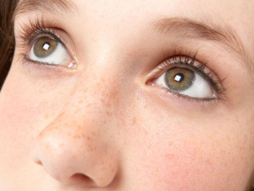 脸上出现蝴蝶斑怎么去掉啊,脸上有两块对称的蝴蝶斑怎么回事