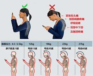 脖子前伸驼背怎么矫正,矫正脖子前伸