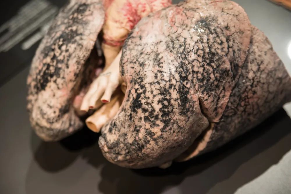 戒烟之后,变黑的肺还能白回来吗?