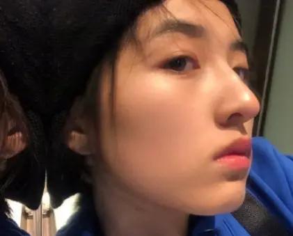 想要摆脱大油鼻，在夏天做到这三点，给你张子枫般的皮肤状态！