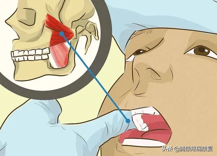 如何缓解紧张焦虑头痛,肌紧张性头痛的症状