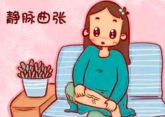 求科普精索静脉曲张,静脉曲张算小病么