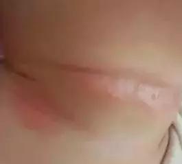 淹脖子期间可以用爽身粉吗,宝宝夏天淹脖子抹点爽身粉