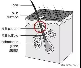 改善黑头和去黑头有什么区别,黑头用黑头膏为什么去不掉黑头
