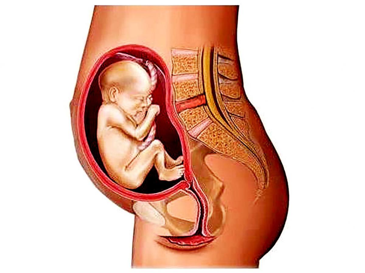 孕妇腰椎间盘突出锻炼操,如何缓解孕妇腰椎间盘突出