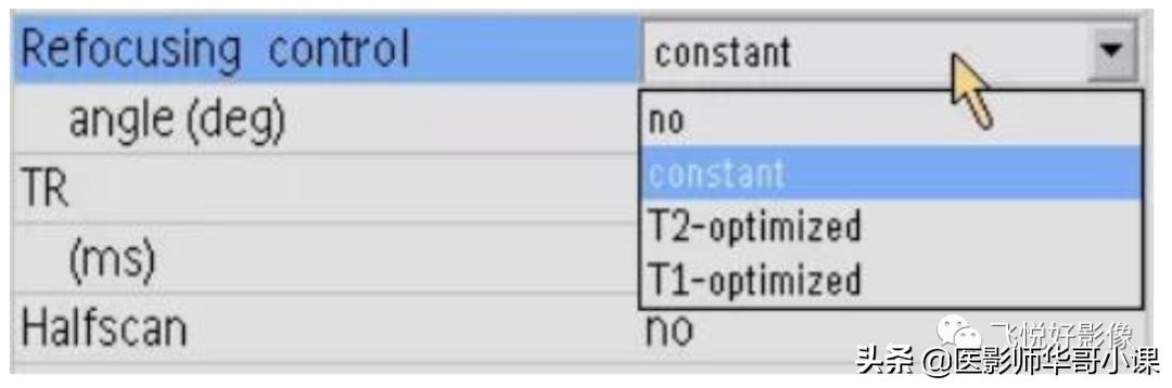 飞利浦磁共振波谱扫描方案,飞利浦1.5t磁共振mri操作使用手册