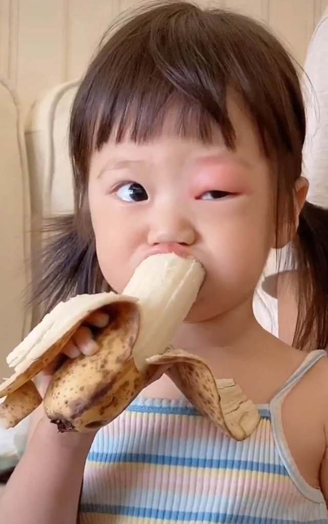 被蚊子叮眼睛的宝宝视频,萌娃被蚊子咬成大耳朵图图