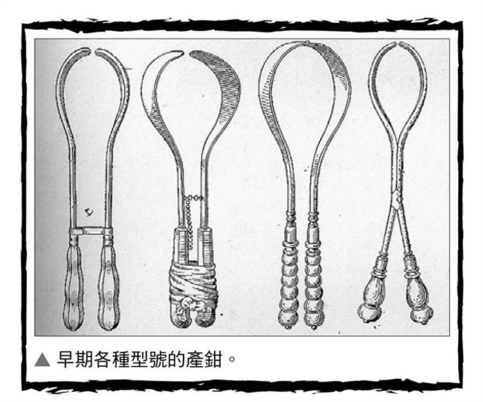 古代没有麻药剖腹产生孩子,古代没有产婆怎么生孩子