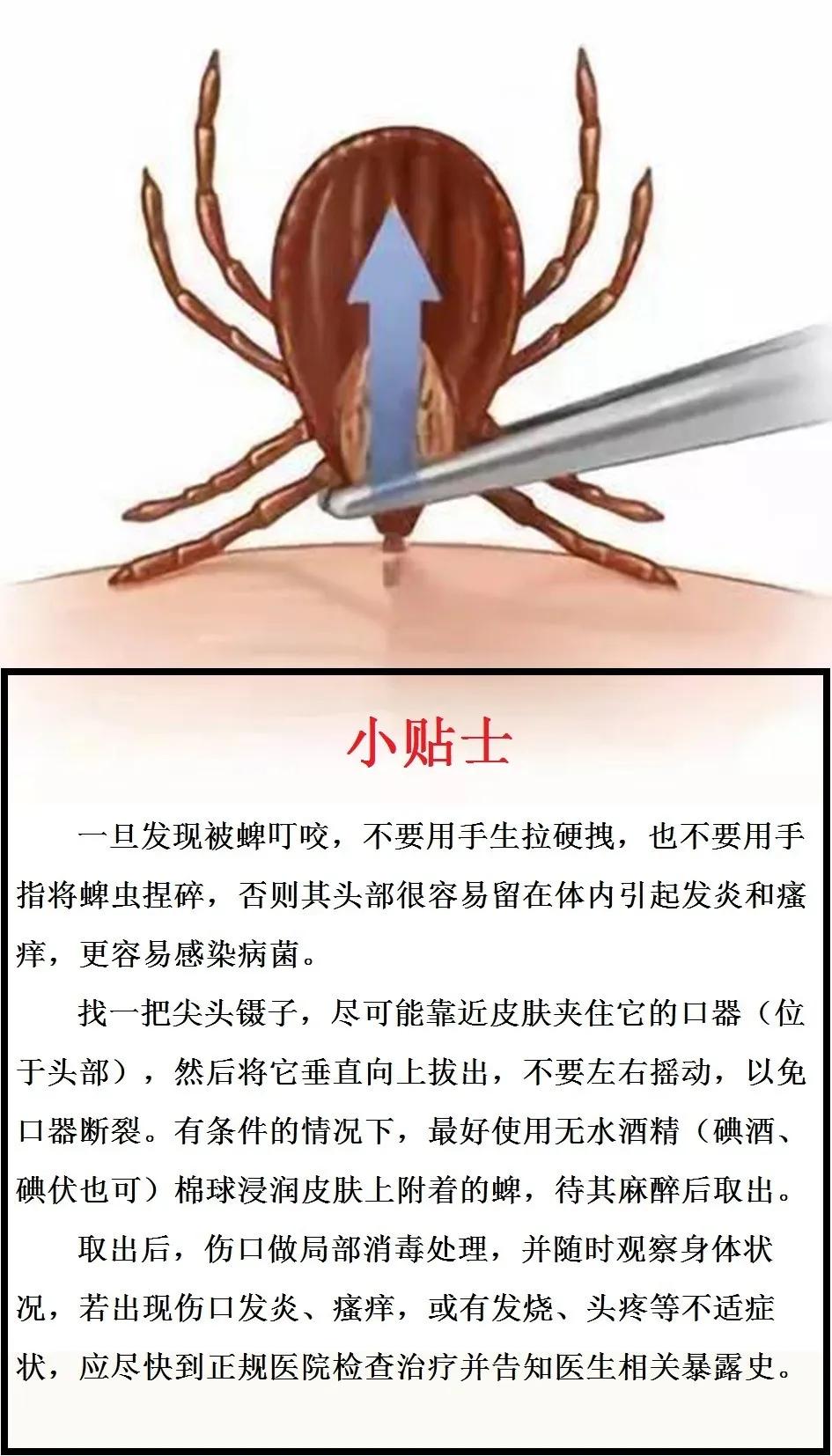 蜱虫引起发烧,蜱虫病老是发烧咋办