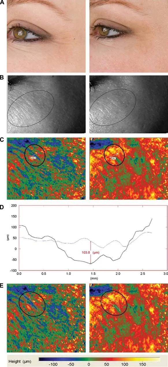 最新款射频美容仪,最好用的家用射频美容仪器