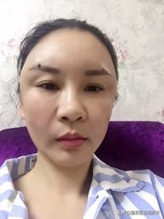 自体脂肪填充量有标准吗,自体脂肪填多了可以取出吗