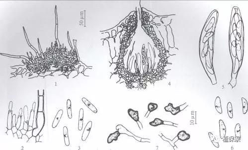 炭疽病怎么来的,炭疽病症状如何预防