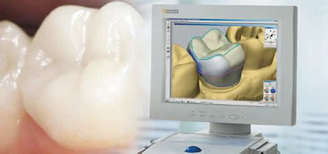 牙齿矫正和种植牙,牙齿矫正和烤瓷牙哪个更简单