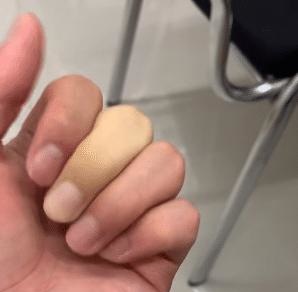 什么情况下医生会建议截肢,医生一般什么情况才建议截肢