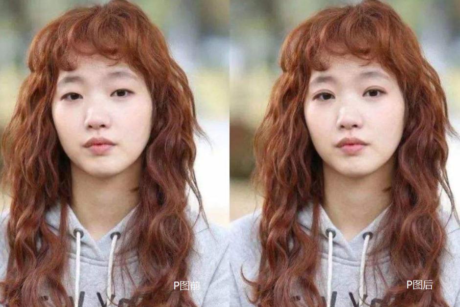 原来双眼皮不好看有必要继续割吗,双眼皮越看越奇怪怎么办