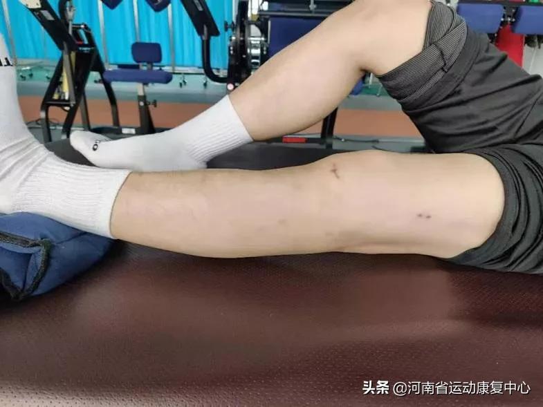 前交叉韧带断裂术后2-3周康复,膝盖交叉韧带断裂康复训练第三周