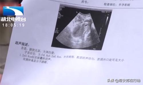 孕妇宫缩打保胎针没有效果怎么办,孕妇打了保胎针一直痛怎么办