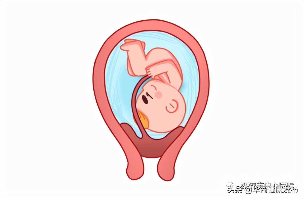 为什么容易发生前置胎盘,前置胎盘到底可不可怕