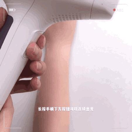 世界公认脱毛最有效的方法,目前最好的脱毛技术