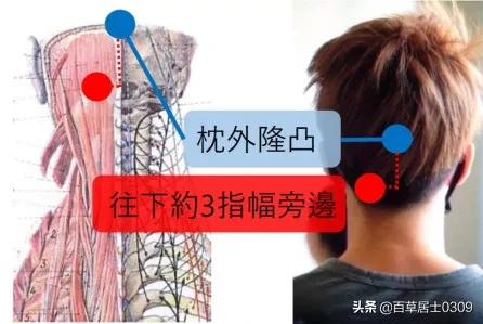 经常头沉重肌肉紧绷,经常头痛头紧绷是什么原因