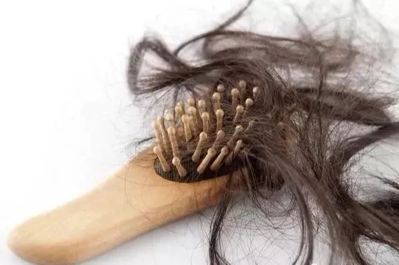 防秃最有效的偏方,防脱发小妙招你学会了吗