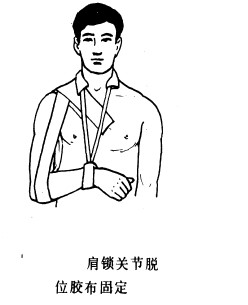 浏阳骨伤科医院髋关节脱位,肩锁关节脱位看骨伤科吗