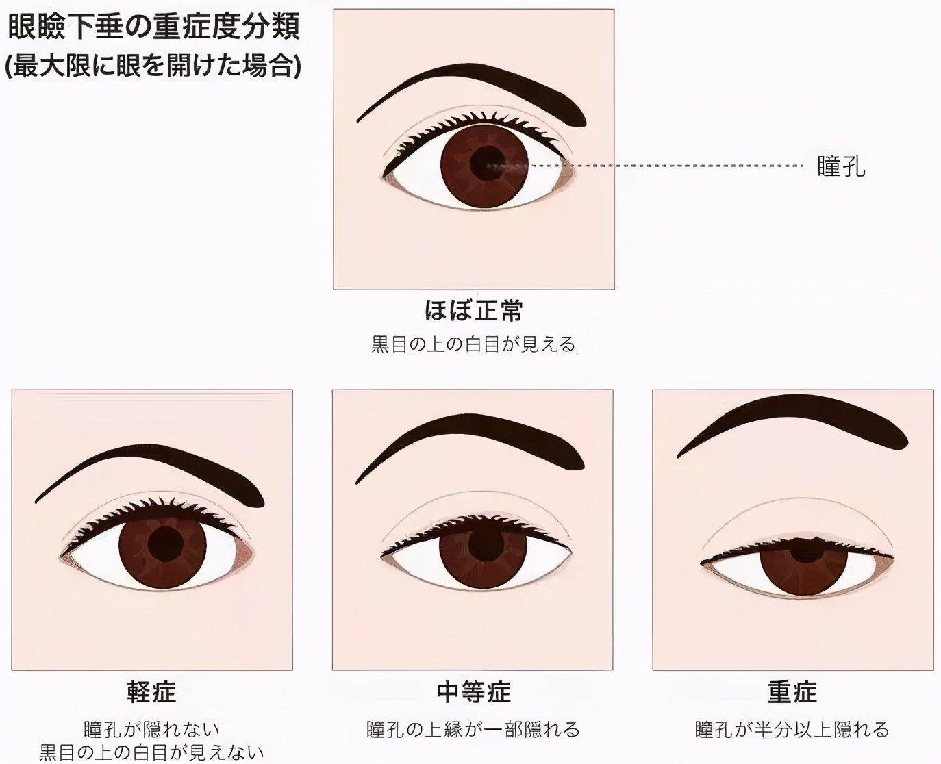 她为什么没眼技？怎么改善眼睛无神的状态