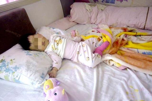 从小睡枕头会影响孩子吗,小孩睡枕头和不睡枕头的头型对比