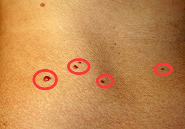 身上出现小红点一定要注意,身上出现小红点是什么原因引起的