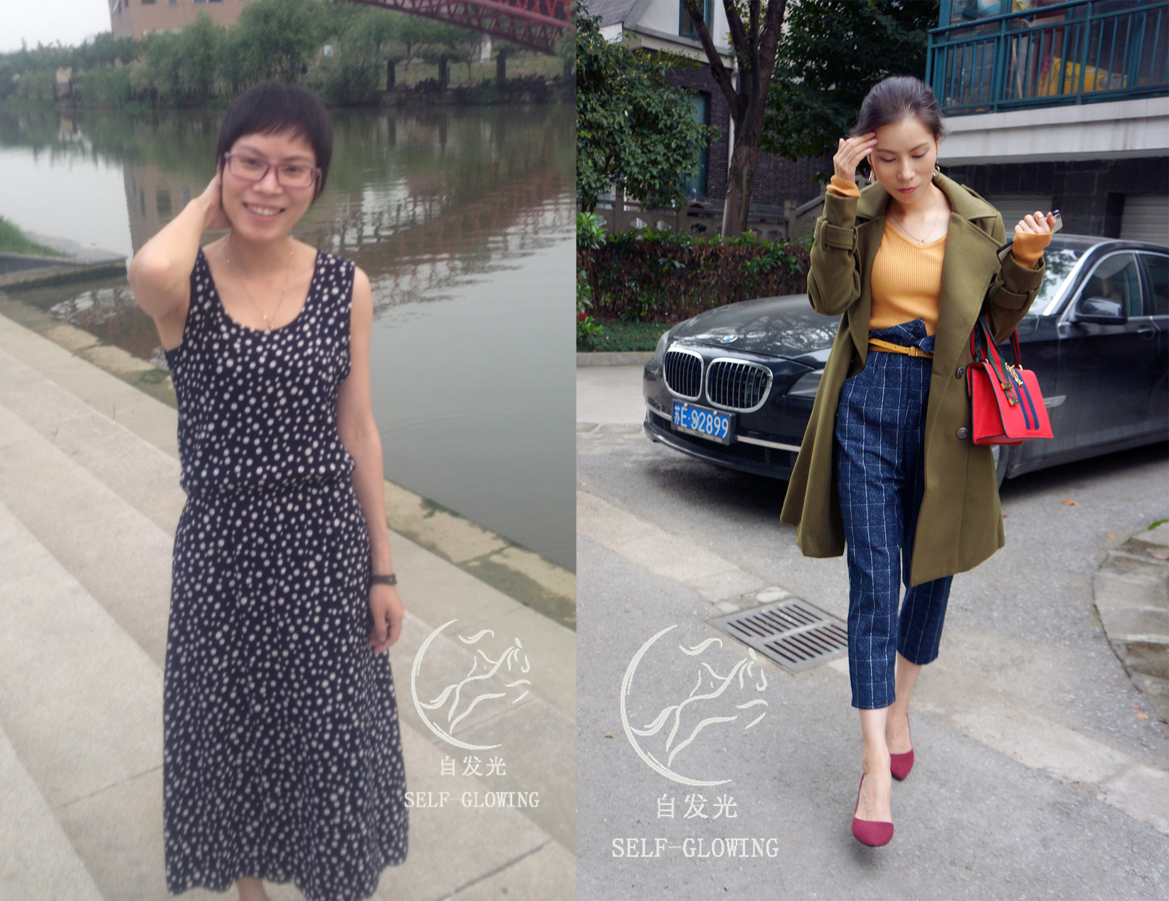 颧骨突出微调填充,颧骨外扩是要磨骨还是填充